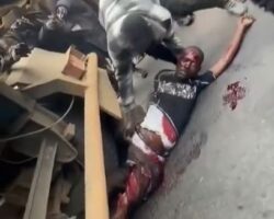 Severely injured man dying after collision with truck