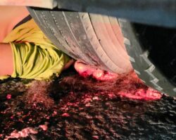 Truck squeezed woman’s brain out