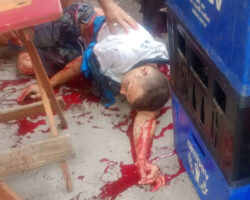 Violently attacked with machete while hanging out with friends