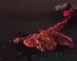 Biker’s intestines squeezed out in traffic accident