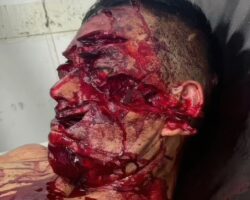 Brutal machete attack on street