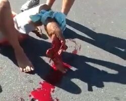 Couple suffered terrible injuries in motorcycle accident