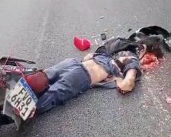 Crushed head in motorcycle accident