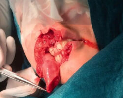 Dog ripped off part of her face