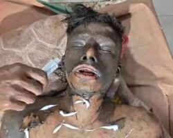 Dude set himself on fire because of rejection from girl