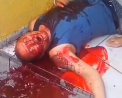 Dying man vomits blood after gunshot wound to abdomen