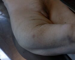 Elderly female pedestrian fatally struck by car