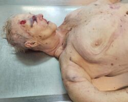 Elderly woman passed away after suffering fatal fall