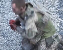 Explosion tore off both hands of Ukrainian soldier
