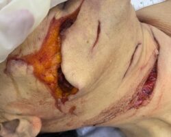 Initial forensic assessment of fatal stabbing victim