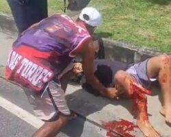 Open fracture of tibia after motorcycle crash