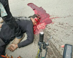 Syrian motorcyclist’s brain splattered across road