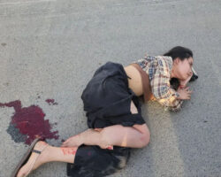 Young Cambodian woman lost her leg in collision with car