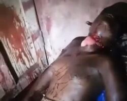 Young african woman stabbed and slashed by her boyfriend