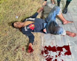 Attacked with machete by unknown assailant