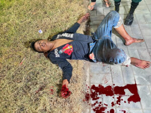 Attacked with machete by unknown assailant