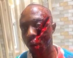 Cow herder attacked him with sword