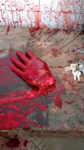 Dude cut off his own hand with machete