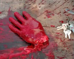 Dude cut off his own hand with machete