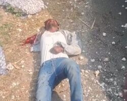 Entire arm torn off in traffic accident