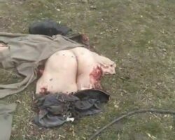 Explosion tore off Russian soldier’s buttocks