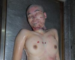 Female victim of machete attack #2