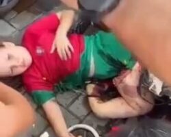 Girl suffers shattered legs in traffic accident