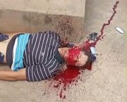 Motorcyclist in critical condition after traffic accident