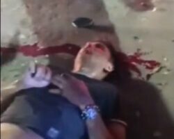 Motorcyclist suffered head injury in collision with car