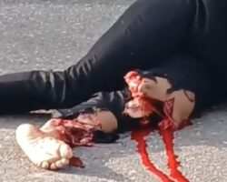 Mutilated couple after motorcycle accident