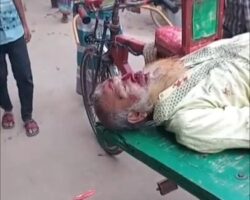 Pedestrian destroyed after collision with car