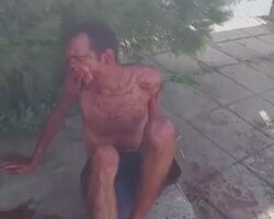 Pit bull tore a thief’s face apart