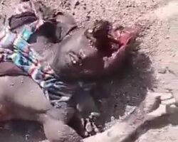 RSF soldier with huge hole in his head