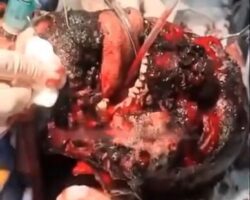 Russian soldier with charred face