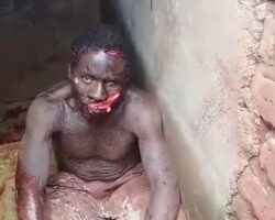 Severe facial injury after machete attack