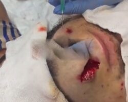 Treatment of injured soldier in field hospital