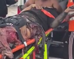 Truck completely crushed his leg