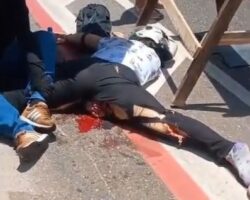 Truck crushed her so badly that her intestines were forced out