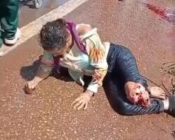 Woman suffered nasty leg injury