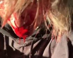 Young man attacked and brutally beaten over fur coat