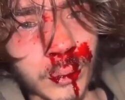 Bloodily beaten up over Instagram argument