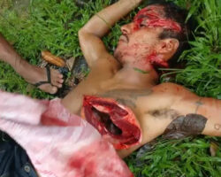 Brutal aftermath of machete attack