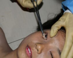 Examination and autopsy of Chinese woman #2