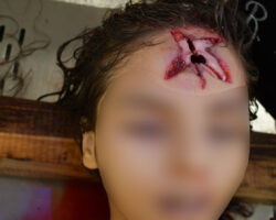 Examination and autopsy of murdered teenager