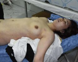 Examination of dead Chinese woman #12