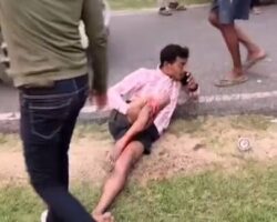 Gruesome leg injury from motorcycle crash