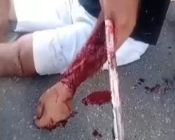 Impaled on fence in motorcycle crash
