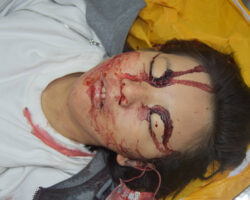Initial examination of dead Chinese teenager