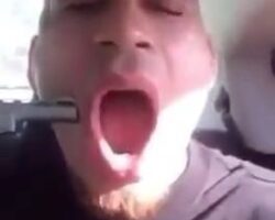 Man shoots himself in cheek