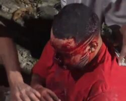 Motorcyclist smashed his teeth in head-on crash into wall